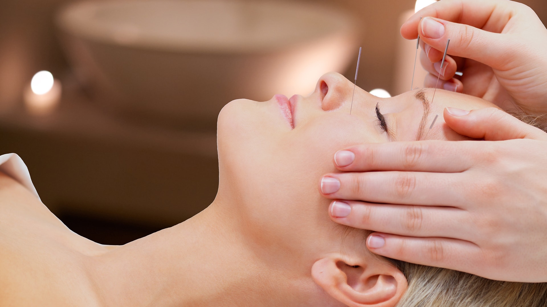 Face Acupuncture